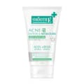 Smooth E Acne Extra Sensitive Cleansing Gel 120ml